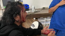 Iren (korban) mendatangi RS Siloam Labuan Bajo usai dianiaya oknum Polisi, Minggu(22/12/2024)